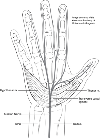 Carpal Tunnel Syndrome | Genesis Orthopedics & Sport Medicine