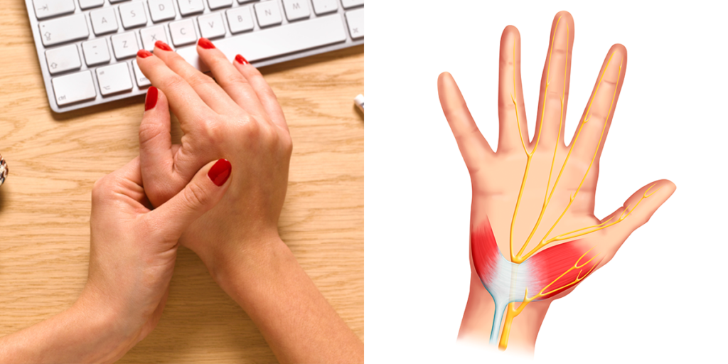 Carpal Tunnel Release Genesis Orthopedic And Sports Medicine