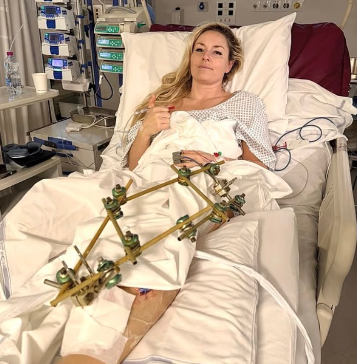 Lindsey Vonn Olympic Crash: Orthopedic Expert Explains